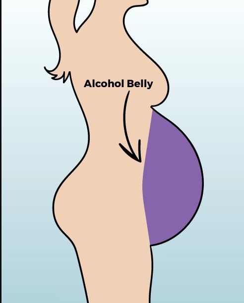 FOTO// De ce grăsimea de pe burtă are diferite forme și cum să scapi de ea