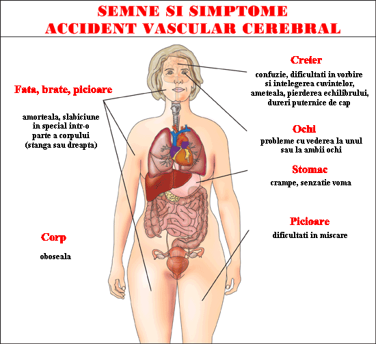 dureri de umăr cu accident vascular cerebral